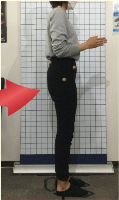 20代女性の施術後の姿勢