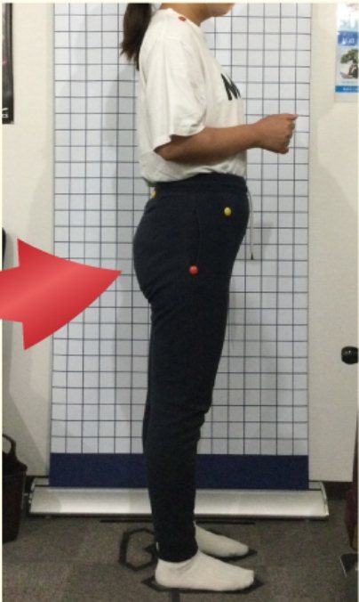 30代女性の施術後の姿勢