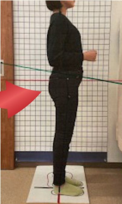 20代女性の施術後の姿勢