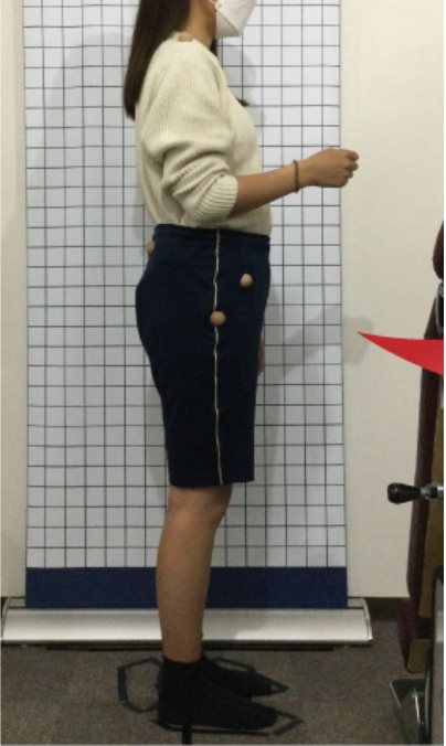 20代女性の施術前の姿勢