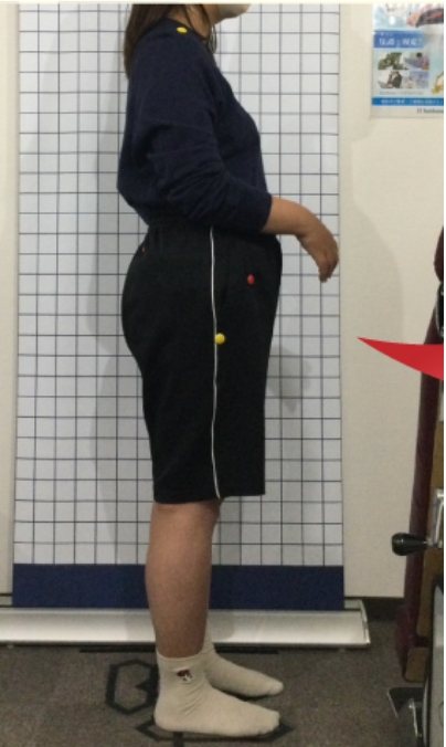 30代女性の施術前の姿勢